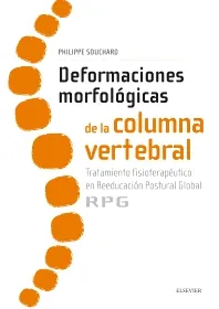 DEFORMACIONES MORFOLÓGICAS DE LA COLUMNA VERTEBRAL-ISBN:9788491130635