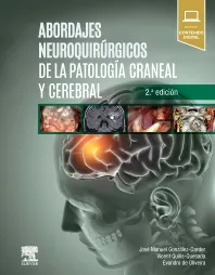 ABORDAJES NEUROQUIRÚRGICOS DE LA PATOLOGÍA CRANEAL Y CEREBRAL-ISBN: 9788491135029
