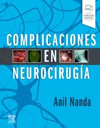 COMPLICACIONES EN NEUROCIRUGÍA_ISBN: 9788491137757