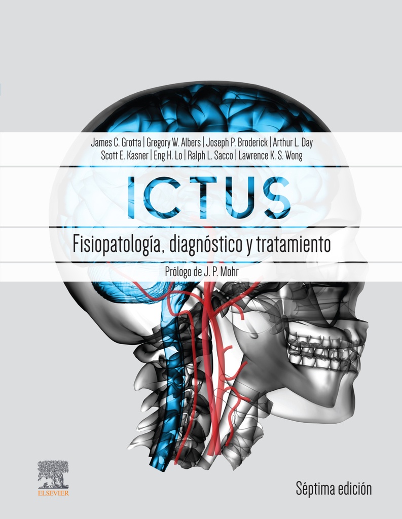ICTUS: FISIOPATOLOGÍA, DIAGNÓSTICO  Y ABORDAJE