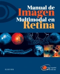CLUB ESPAÑOL DE LA MÁCULA, MANUAL DE IMAGEN MULTIMODAL EN RETINA