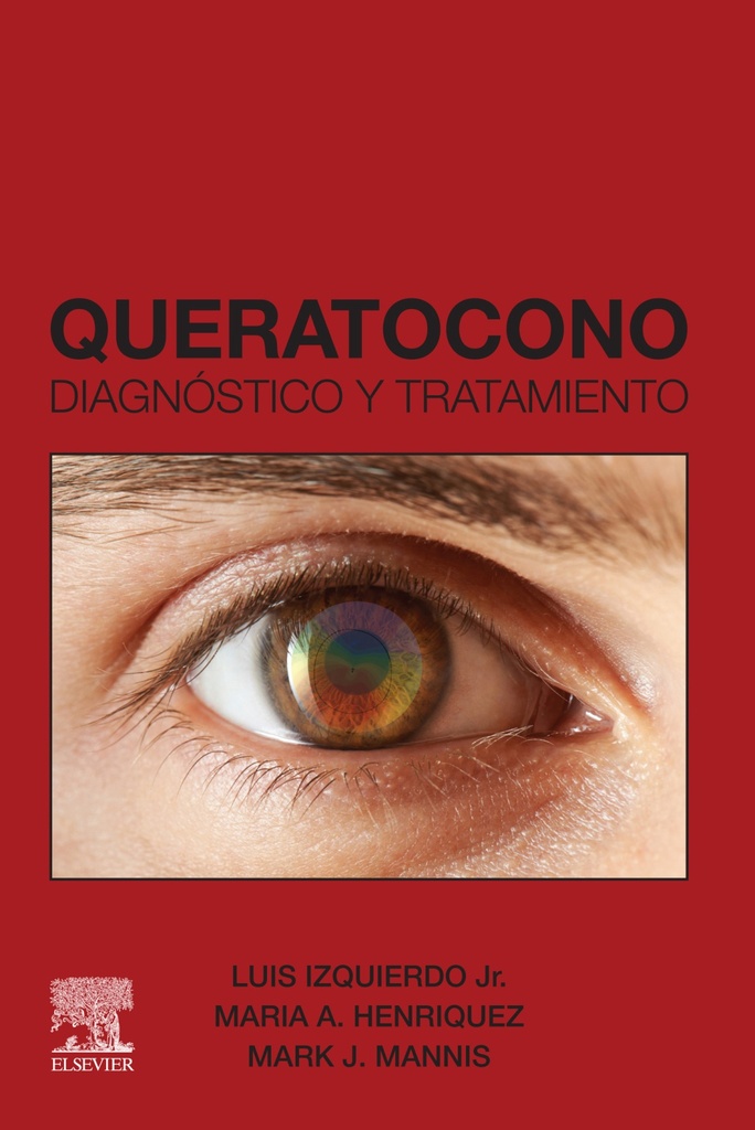 QUERATOCONO