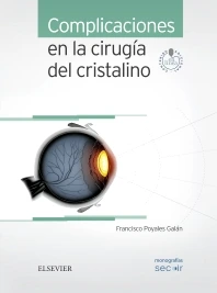 COMPLICACIONES EN LA CIRUGÍA DEL CRISTALINO
