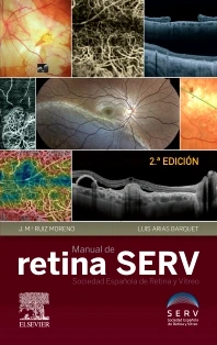 MANUAL DE RETINA SERV