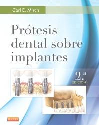 PRÓTESIS DENTAL SOBRE IMPLANTES-ISBN: 9788490228630