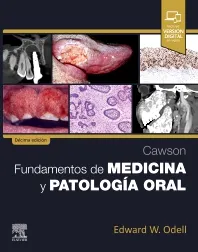 CAWSON.FUNDAMENTOS DE MEDICINA Y PATOLOGÍA ORAL-ISBN:9788413828169