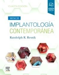 MISCH.  IMPLANTOLOGÍA CONTEMPORÁNEA