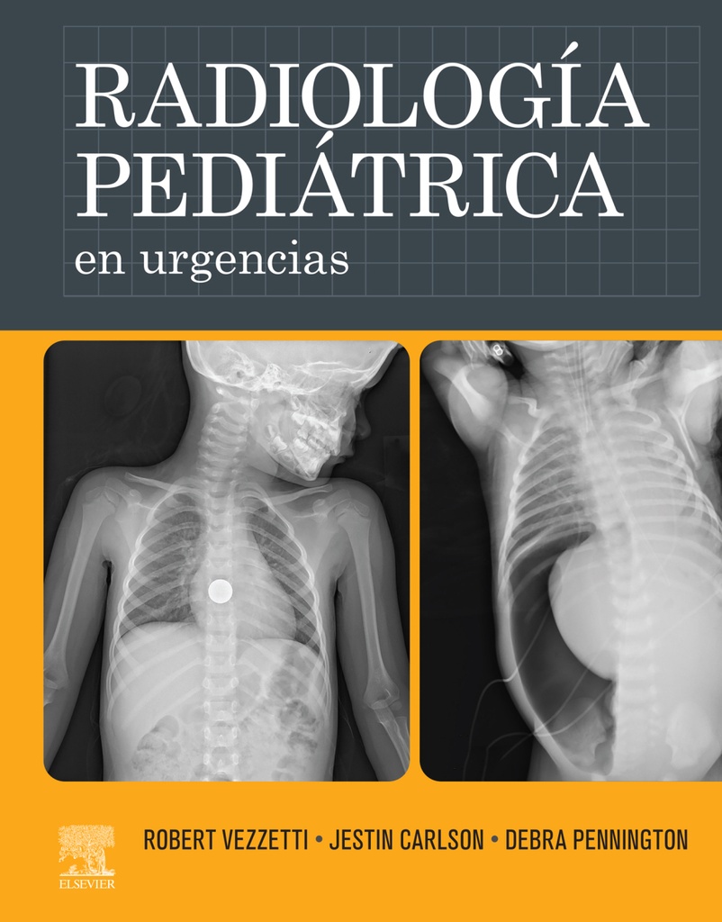 RADIOLOGÍA PEDIÁTRICA EN URGENCIAS