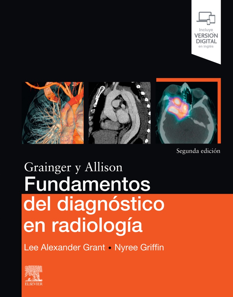 FUNDAMENTOS DEL DIAGNÓSTICO EN RADIOLOGÍA