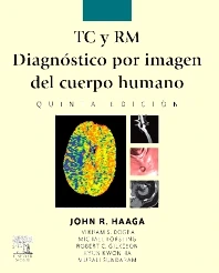 TC Y RM. DIAGNÓSTICO POR IMAGEN DEL CUERPO HUMANO
