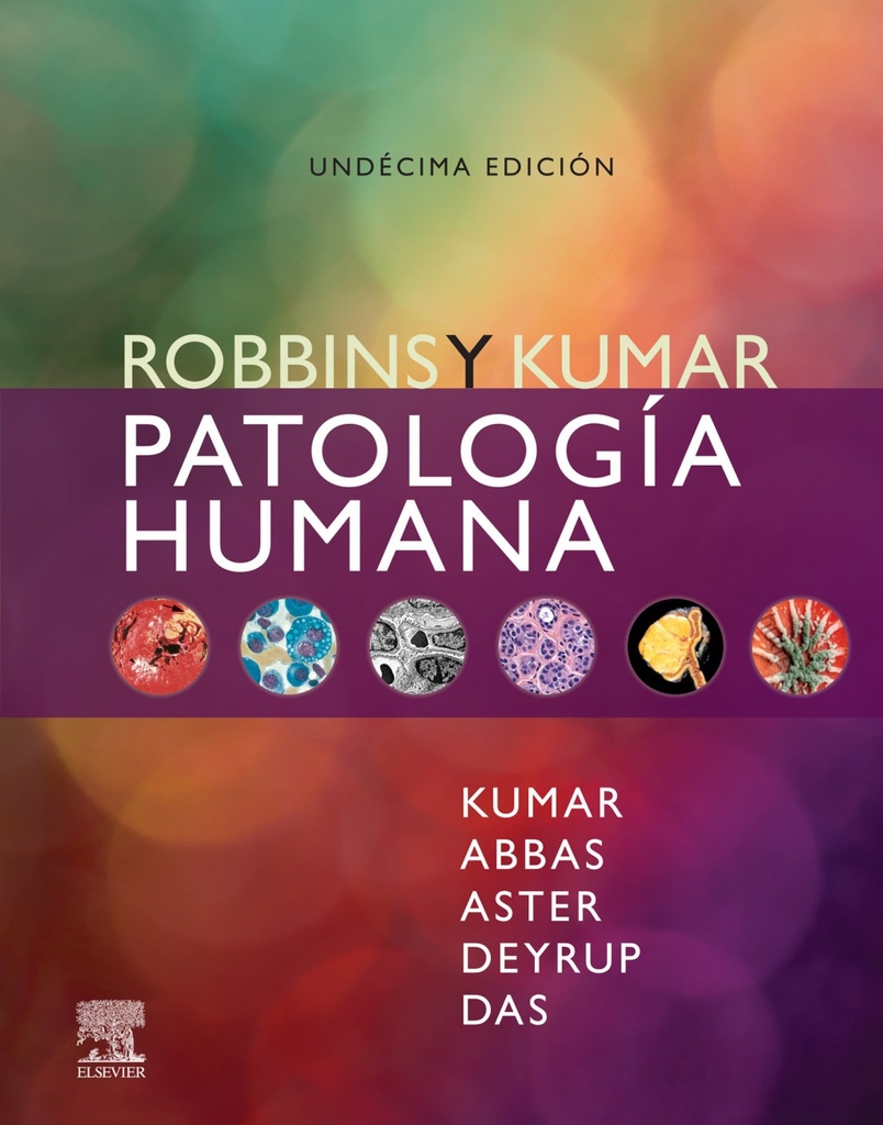 ROBBINS. PATOLOGÍA HUMANA