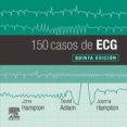150 CASOS DE ECG-ISBN:9788491135043