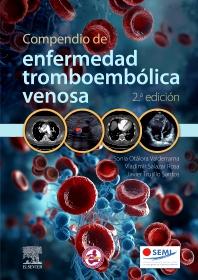 COMPENDIO DE ENFERMEDAD TROMBOEMBÓLICA VENOSA_ISBN: 9788413824277