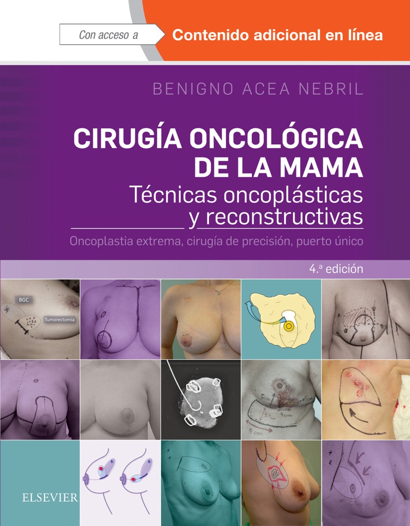 CIRUGÍA ONCOLÓGICA DE LA MAMA-ISBN:9788491131120