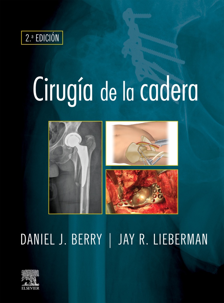 CIRUGÍA DE LA CADERA-ISBN:9788491139003