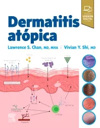 DERMATITIS ATÓPICA-ISBN:9788413824413